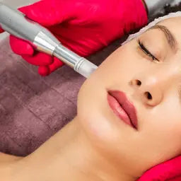 Micro-needling