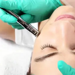 Micro Dermabrasion
